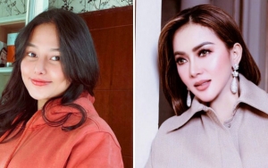 Dara Arafah Ternyata Terinspirasi Dengan Hidung Syahrini, Sebut Juga Hasil Operasi Di Tompi  