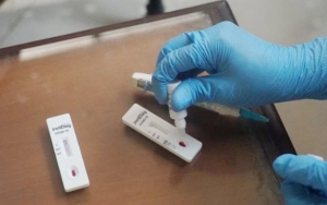 Soal Rapid Test Nonreaktif tapi Swab Positif, Begini Penjelasan Satgas COVID-19