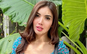 Millendaru Pamer Foto Umbar Dada, Bagian Bibir Makin Tebal Diejek Jontor dan Mirip Bekicot