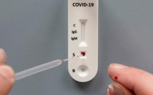Setuju Dengan AS, Epidemiolog UI Tegaskan Rapid Test Corona Tak Efektif