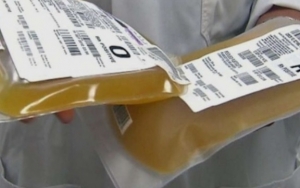 Penasihat Ungkap Gedung Putih Paksa Badan Obat-Obatan AS untuk Setujui Terapi Plasma Darah COVID-19