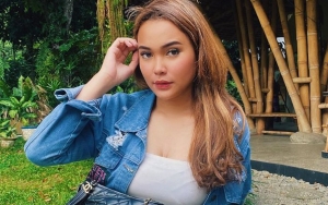 Biasa Dibully, Dinda Shafay Kecam Prank Wajah 'Bopeng' Jerawatan Justru Banjir Ucapan Terima Kasih