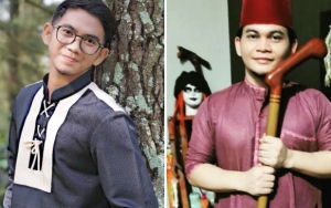 Kejanggalan Foto Rizki DA Peluk Pohon Dibongkar Mbah Mijan, Mata Kosong Dikuasai 'Wanita Gaib'?