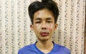 Penusuk Syekh Ali Jaber Disebut Gangguan Jiwa, Polda Lampung Lakukan Pemeriksaan