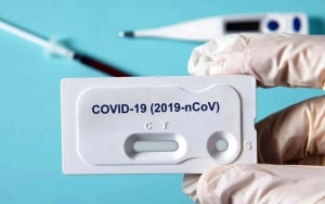 Mirip HIV/AIDS, Virus Corona Juga Berpotensi Serang Antibodi