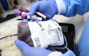 PMI Harap Penyintas Corona Rela Donorkan Plasma Darah Demi Selamatkan Nyawa, Ini Prosedurnya