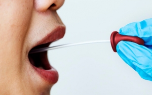 Biaya Tes Swab Rp 900 Ribu, Pemerintah Diminta Beri Subsidi ke Warga Tak Mampu