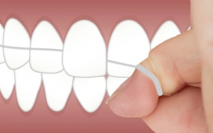 Ajarkan Flossing dan Rinsing