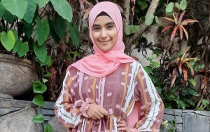 Nadya Istri Rizki DA Dikritik Gara-gara Edit Foto Berlebihan, Hidung Super Mancung Jadi Sorotan