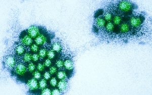 Kemenkes Akui Sudah Deteksi Norovirus di Indonesia Sejak Lama, Gejala Disebut Mirip Diare