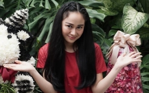 Kecantikan 'Tak Diakui' Netizen, Denise Chariesta Blak-blakan Lakukan Operasi Plastik