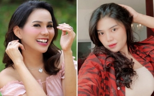 Isa Zega Dipukul Orang Tak Dikenal Hingga Hidung Berdarah, Rosa Meldianti Ungkap Kondisi Terkini