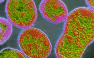 Kembali Diserang Wabah Brucellosis, Lebih dari 6.000 Warga Tiongkok Terinfeksi