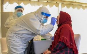 Pengakuan Pasien: Long COVID-19 Buat Gusi Berdarah Hingga Rambut Rontok