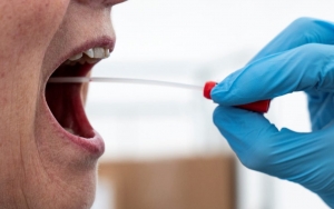 Jelang Pilkada, Ribuan Pengawas TPS di Surabaya Jalani Tes Swab