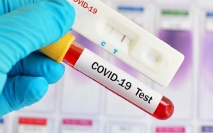 WHO Sorot Kesenjangan Jumlah Kasus Suspek dan Testing COVID-19 di Indonesia 
