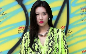 Sunmi Ungkap Kondisi Lututnya yang Alami Cedera, Ternyata Lebih Buruk dari Perkiraan
