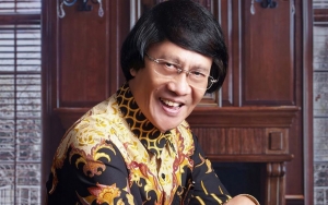 Kak Seto Beber Kisah Dibalik Postingan Viral Pamer Rambut Asli: Kalau Foto Harus Selalu Pakai Baju