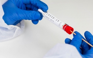 Siap-Siap! Pelancong Wajib Tes PCR-Rapid Antigen Sebelum ke Bali
