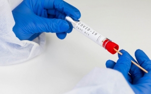 Wajib Rapid Antigen Saat Liburan Ke Luar Kota, Ini Harga Yang Dipatok Di Bandara