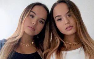 Bibir The Connell Twins Jadi Bahan Gosip, Nama Lucinta Luna Ikut Terseret