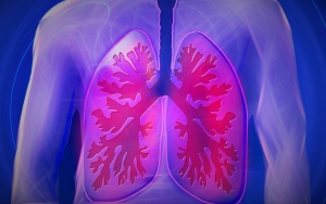 Gejala COVID-19 dan Pneumonia 'Paru-Paru Basah' Nyaris Serupa, Begini Cara Membedakannya