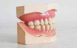 Merawat Kesehatan Gigi dan Mulut