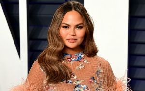 Chrissy Teigen Curhat Kehilangan Gigi Usai Pelantikan Joe Biden