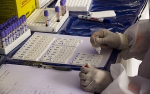 Polisi Bongkar Modus Jual-Beli Hasil Swab Palsu, Ini Peran 8 Tersangka Di Aksi Itu