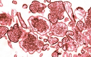 Bukan Ancaman Baru, Virus Nipah Sempat Mewabah di Malaysia 22 Tahun Lalu