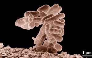 Escherichia coli