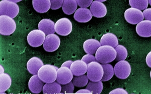 Staphylococcus aureus