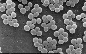 Coagulase Negative Staphylococci (CoNS)