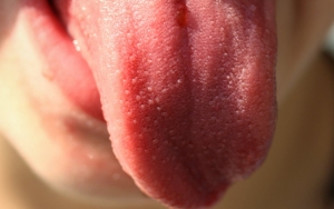 Waspadai 'Covid Tongue', Gejala Baru Corona Pada Lidah