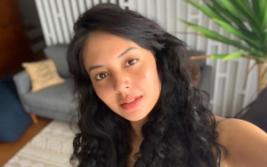 Aurelie Moeremans Bikin Khawatir Posting Foto Dengan Mata Sembab Hingga Banjir Dukungan
