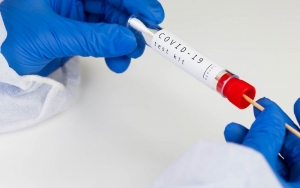 Dongkrak Tracing, Kemenkes Gunakan Rapid Test Antigen Untuk Diagnosis Kasus COVID-19