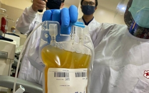 Ternyata Tak Semua Plasma Konvalesen Penyintas COVID-19 Baik untuk Donor, Ini Penjelasannya