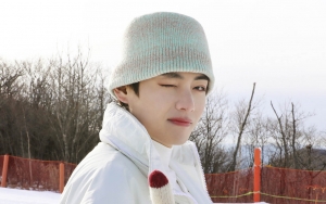 Begini Reaksi Fans Saat V BTS Bertanya Apakah Ia Sebaiknya Operasi Kelopak Mata