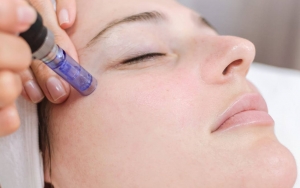 Efektif Percantik Kulit, Ini 7 Hal yang Perlu Diketahui Tentang Microneedling