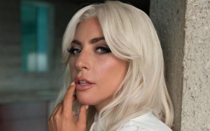 Staf Lady Gaga Ditembak dan 2 Anjingnya Dicuri, Sang Ayah Gambarkan Situasi Menakutkan