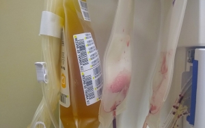 Tak Perlu Ragu! Pendonor Plasma Konvalesen Disebut Bakal Rasakan Keuntungan Ini