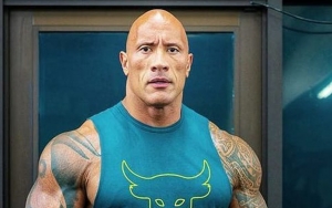 Dwayne Johnson Pertama Kali Coba Terapi Bekam, Begini Potretnya
