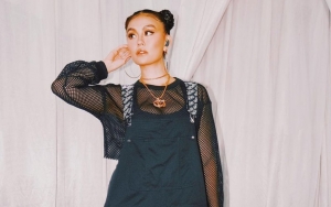 Agnez Mo 'Buka Suara' Usai Wajahnya Disebut Berubah Drastis Hingga Bibir-Hidung Dikira Oplas