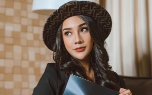 Anya Geraldine Jawab Begini Soal Tudingan Lakukan Operasi Plastik Di Bagian Bibir