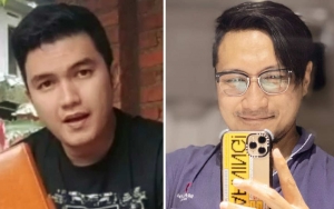 Aldi Taher Doakan Kesembuhan Arie Untung Malah Dihujat, Kenapa?
