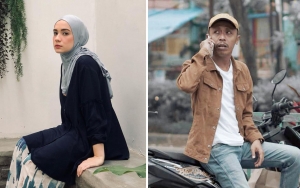 Putri Anne Unggah Foto Diri Sebut Ratu Usai Heboh Soal Unfollow, Komentar Furry Setya Bikin Salfok