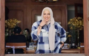 Jane Shalimar Santai Kena Nyinyir Usai Foto Tanpa Hijab Beredar, Curhat Punya Masalah Kulit Kepala