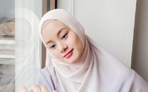Usia Kehamilan Masuki 32 Minggu, Dinda Hauw Beber Perubahan Sikapnya ke Suami