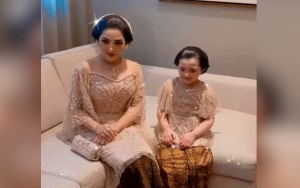 Gigi Arsy Putri Ashanty Berdarah Saat Liburan di Legoland Dubai, Ternyata Gara-gara Ini
