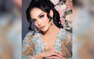 Bukan Rp 1 Miliar, Krisdayanti Bongkar Biaya Sesungguhnya Untuk Suntik DNA Ikan Salmon